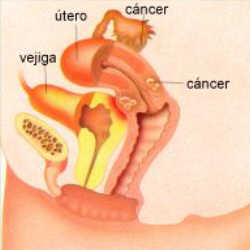 foto Medicina la Ginecologia