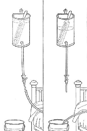 foto Sex Clinical Enema o Clistere